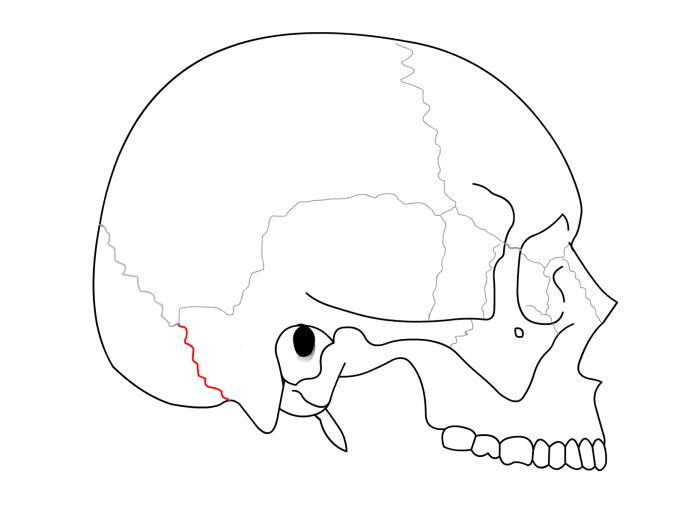 Occipitomastoid_suture